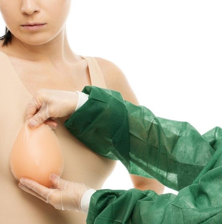 Εμφυτεύματα μεγέθυνσης του μαστού